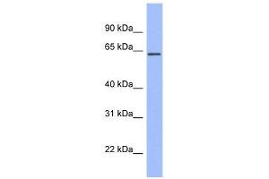 RPA1 antibody used at 1 ug/ml to detect target protein. (RPA1 Antikörper  (Middle Region))