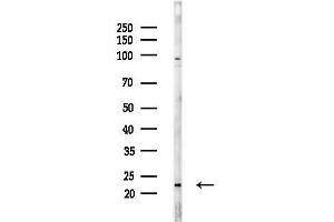 anti-Double Homeobox 5 (DUX5) (N-Term) antibody