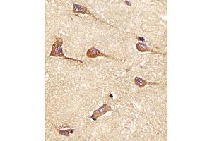 (ABIN6242187 and ABIN6577955) staining PH in Human brain tissue sections by Immunohistochemistry (IHC-P - paraformaldehyde-fixed, paraffin-embedded sections). (Amphiphysin Antikörper  (AA 336-370))