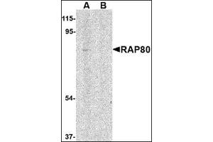 Western blot analysis of RAP80 in 293 cell lysate in (A) the absence and (B) presence of blocking peptide with this product at 1 μg/ml. (UIMC1 Antikörper  (N-Term))