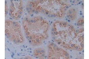 Immunohistochemistry (IHC) image for anti-LI Cadherin (AA 67-351) antibody (ABIN7434515)