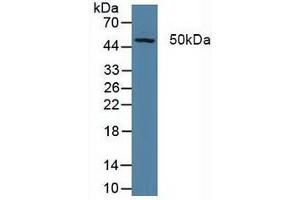 Detection of XPG in Porcine Liver Tissue using Polyclonal Antibody to Xeroderma Pigmentosum, Complementation Group G (XPG) (ERCC5 Antikörper  (AA 778-986))