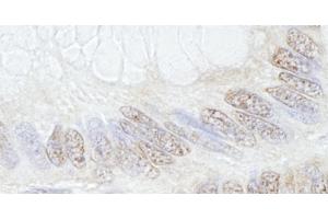 Immunohistochemistry (IHC) image for anti-Tripartite Motif Containing 33 (TRIM33) (C-Term) antibody (ABIN7448843) (TRIM33 Antikörper  (C-Term))