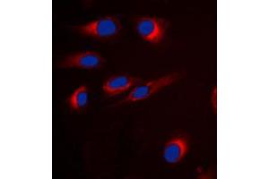 Immunofluorescent analysis of GPR18 staining in H9C2 cells. (GPR18 Antikörper  (Center))
