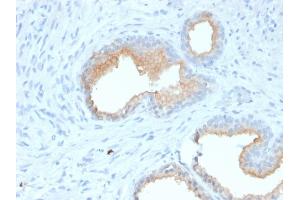 Immunohistochemistry (IHC) image for anti-Membrane Metallo-Endopeptidase (MME) (AA 297-483) antibody (ABIN6940058)