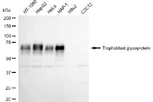 anti-Trophoblast Glycoprotein (TPBG) antibody