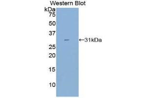 Western Blotting (WB) image for anti-Cytochrome P450, Family 21, Subfamily A, Polypeptide 2 (CYP21A2) (AA 37-264) antibody (ABIN3206433) (CYP21A2 Antikörper  (AA 37-264))