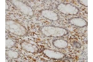 Immunoperoxidase of monoclonal antibody to SEPHS2 on formalin-fixed paraffin-embedded human colon. (SEPHS2 Antikörper  (AA 61-150))