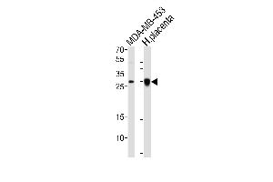 Western blot analysis of lysates from MDA-MB-453 cell line, human placenta tissue lysate (from left to right), using FOLR2 Antibody at 1:1000 at each lane. (FOLR2 Antikörper  (N-Term))