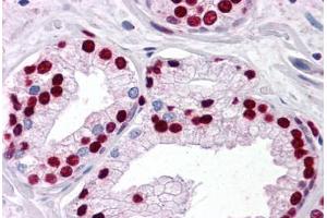 Human Prostate: Formalin-Fixed, Paraffin-Embedded (FFPE) (SMAD6 Antikörper  (AA 285-385))