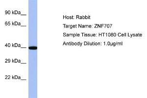 Host: Rabbit Target Name: ZNF707 Sample Type: HT1080 Whole cell lysates Antibody Dilution: 1. (ZNF707 Antikörper  (C-Term))