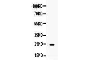 Western blot analysis of FGF1 expression in rat cardiac muscle extract ( Lane 1). (FGF1 Antikörper  (AA 16-155))