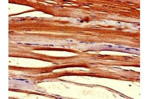 Immunohistochemistry of paraffin-embedded human skeletal muscle tissue using ABIN7172041 at dilution of 1:100 (TMX2 Antikörper  (AA 49-102))