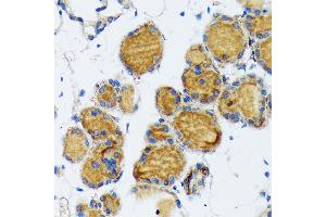 Immunohistochemistry of paraffin-embedded mouse thyroid using Thyroid Peroxidase Rabbit mAb (ABIN7270865) at dilution of 1:100 (40x lens). (TPO Antikörper)