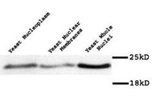 Western blot of Mad2p polyclonal antibody  on yeast preparation. (MAD2 Antikörper)