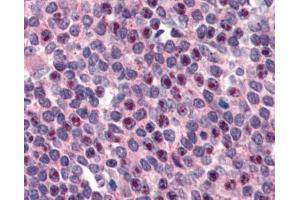 IHC testing of FFPE human spleen tissue with FANCG antibody at 3ug/ml. (FANCG Antikörper)