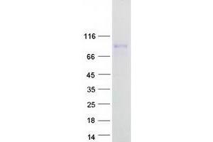 Western Blotting (WB) image for CREB Regulated Transcription Coactivator 1 (CRTC1) (Transcript Variant 3) protein (Myc-DYKDDDDK Tag) (ABIN2712571)