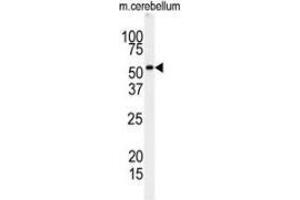 Western blot analysis of RIPK3 (arrow) in mouse cerebellum tissue lysates (35ug/lane) using RIPK3 / RIP3  (RIPK3 Antikörper  (Middle Region))