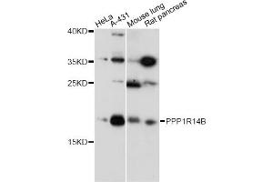 Western blot analysis of extracts of various cell lines, using PPP1R14B antibody (ABIN6294069) at 1:1000 dilution. (PPP1R14B Antikörper)