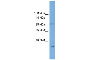 WB Suggested Anti-DENND1A Antibody Titration: 0. (DENND1A Antikörper  (N-Term))
