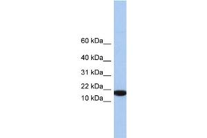 WB Suggested Anti-IL5 Antibody Titration: 0. (IL-5 Antikörper  (Middle Region))
