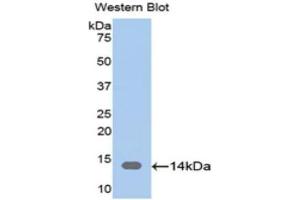 Western Blotting (WB) image for anti-CAP, Adenylate Cyclase-Associated Protein 1 (CAP1) (AA 38-149) antibody (ABIN1174519) (CAP1 Antikörper  (AA 38-149))