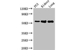 Western Blot Positive WB detected in: PC-3 whole cell lysate, Mouse kidney tissue, Mouse lung tissue All lanes: MMP13 antibody at 2 μg/mL Secondary Goat polyclonal to rabbit IgG at 1/50000 dilution Predicted band size: 54 kDa Observed band size: 54 kDa