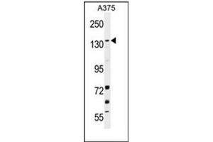 Western blot analysis of JMJD2B Antibody (N-term) in A375 cell line lysates (35ug/lane).