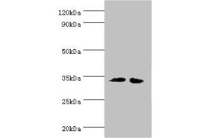 Western blot All lanes: RPH3AL antibody at 12 μg/mL Lane 1: LO2 whole cell lysate Lane 2: K562 whole cell lysate Secondary Goat polyclonal to rabbit IgG at 1/10000 dilution Predicted band size: 35, 32 kDa Observed band size: 35 kDa