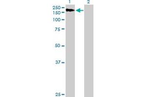 Western Blot analysis of AGL expression in transfected 293T cell line by AGL MaxPab polyclonal antibody. (AGL Antikörper  (AA 1-1532))