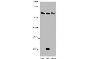 Western blot All lanes: SRF antibody at 12 μg/mL Lane 1: Mouse heart tissue Lane 2: NIH/3T3 whole cell lysate Lane 3: MCF-7 whole cell lysate Secondary Goat polyclonal to rabbit IgG at 1/10000 dilution Predicted band size: 52 kDa Observed band size: 62, 21 kDa (SRF Antikörper  (AA 57-269))