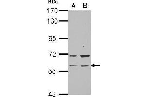 WB Image Sample (30 ug of whole cell lysate) A: NT2D1 B: PC-3 7. (RAP1GDS1 Antikörper  (N-Term))