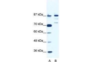 Western Blotting (WB) image for anti-BTB and CNC Homology 1, Basic Leucine Zipper Transcription Factor 1 (BACH1) antibody (ABIN2461624) (BACH1 Antikörper)