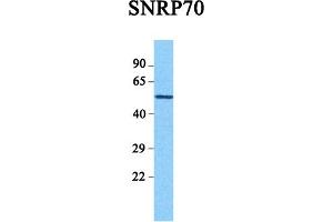 Host:  Rabbit  Target Name:  SNRP70  Sample Tissue:  Human Hela  Antibody Dilution:  1.
