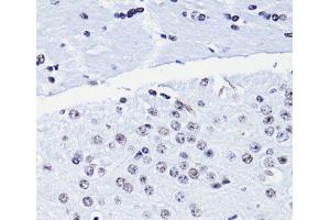 Immunohistochemistry of paraffin-embedded Mouse brain using Acetyl-Histone H4-K8 Polyclonal Antibody at dilution of 1:100 (40x lens). (Histone H4 Antikörper  (acLys8))