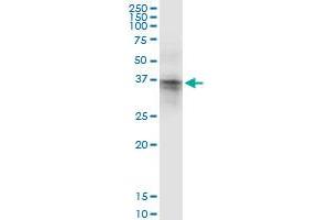 ASPA (Human) IP-WB Antibody Pair