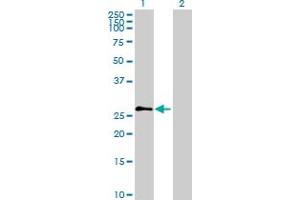 Western Blot analysis of PRSS2 expression in transfected 293T cell line by PRSS2 MaxPab polyclonal antibody. (PRSS2 Antikörper  (AA 1-247))