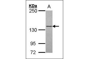Western blot: Sample (30 µg of whole cell lysate).