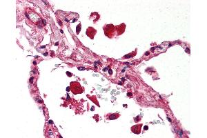 Anti-STAT1 antibody IHC of human lung. (STAT1 Antikörper)