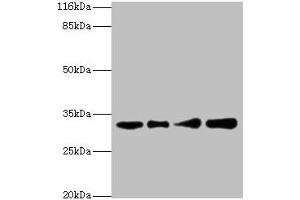 Western blot All lanes: RSU1 antibody at 2 μg/mL Lane 1: Human placenta tissue Lane 2: Caco-2 whole cell lysate Lane 3: Jurkat whole cell lysate Lane 4: HepG2 whole cell lysate Secondary Goat polyclonal to rabbit IgG at 1/10000 dilution Predicted band size: 32, 26 kDa Observed band size: 32 kDa (RSU1 Antikörper  (AA 117-277))
