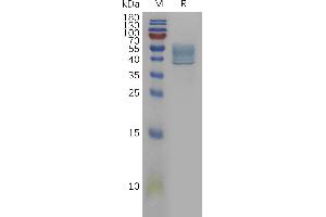 SDS-PAGE (SDS) image for Interleukin 13 (IL13) (AA 35-146) protein (Fc Tag) (ABIN7491185)