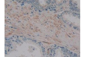 DAB staining on IHC-P; Samples: Human Prostate Tissue (MMP14 Antikörper  (AA 322-541))