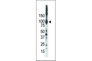 Western blot analysis of anti-PKCepsilon Pab in placenta lysate. (PKC epsilon Antikörper  (N-Term))