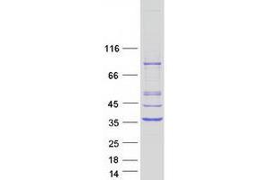 Western Blotting (WB) image for Pyrroline-5-Carboxylate Reductase 1 (PYCR1) (Transcript Variant 1) protein (Myc-DYKDDDDK Tag) (ABIN2730198)