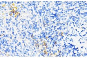 Immunohistochemistry of paraffin-embedded Mouse spleen using CAMP Polyclonal Antibody at dilution of 1:200 (40x lens). (Cathelicidin Antikörper)