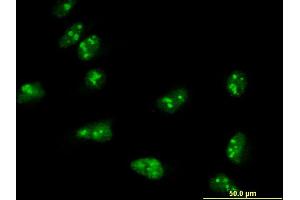 Immunofluorescence of monoclonal antibody to TASP1 on HeLa cell. (TASP1 Antikörper  (AA 1-420))