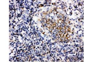 Anti-BAFF antibody, IHC(P) IHC(P): Human Tonsil Tissue