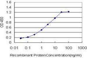 Detection limit for recombinant GST tagged PGR is approximately 0. (Progesterone Receptor Antikörper  (AA 1-110))
