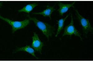 IF analysis of GIT1 using anti-GIT1 antibody (ABIN7601683). (GIT1 Antikörper  (AA 415-736))