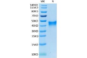 Mouse 4-1BB on Tris-Bis PAGE under reduced condition. (CD137 Protein (AA 24-211) (His tag))
